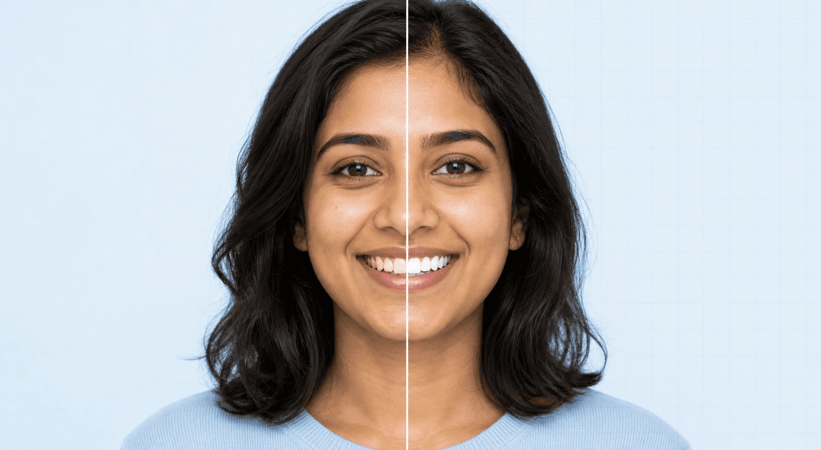 AI preview showing a smile before and after