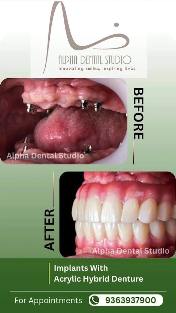 Alpha Dental Studio patient smile before and after treatment