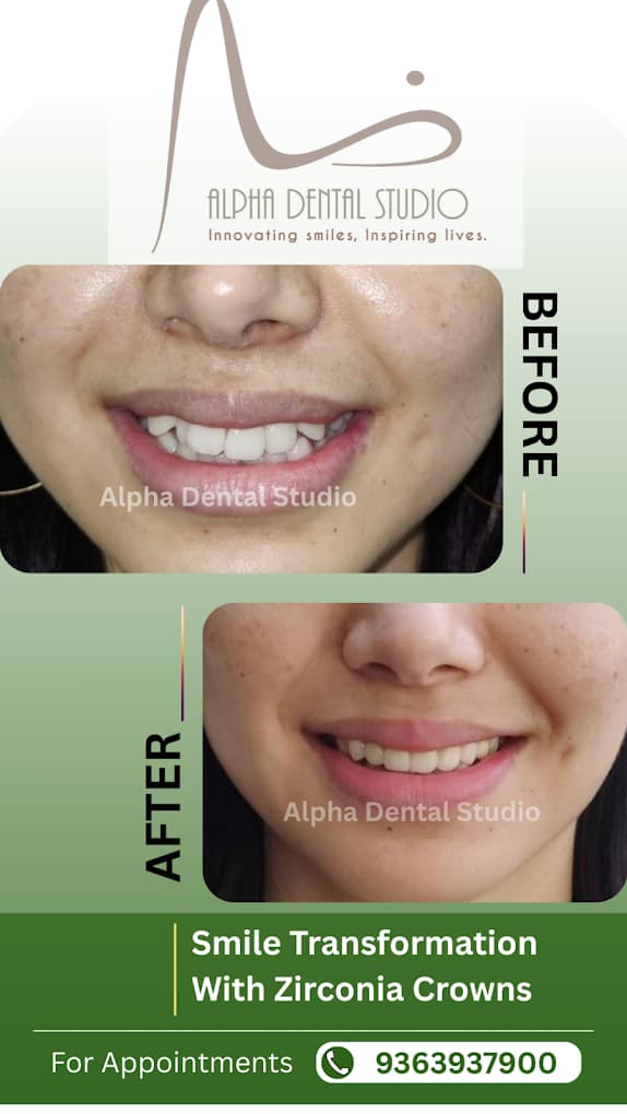 Patient dental transformation before and after treatment