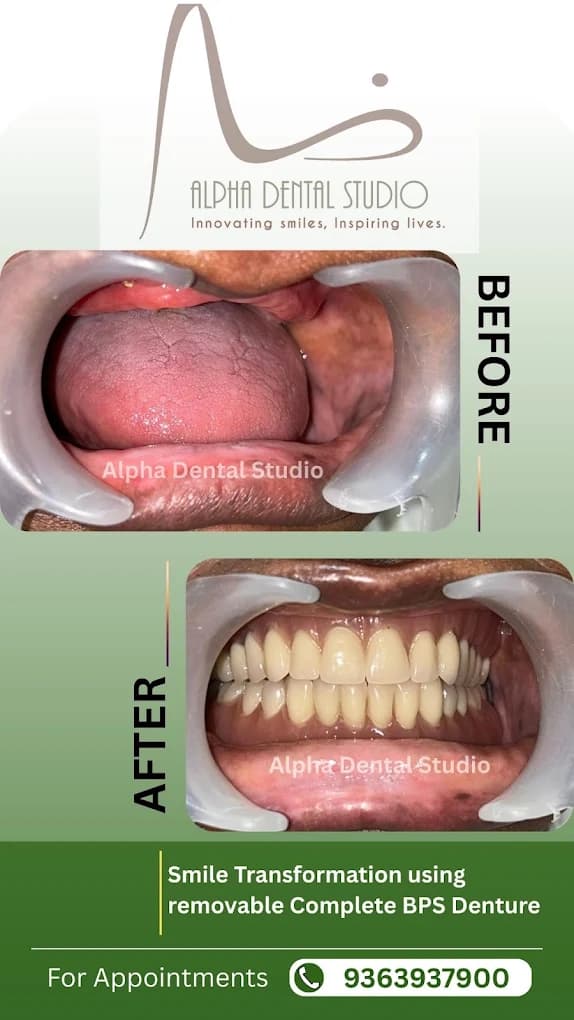 Patient dental transformation before and after treatment